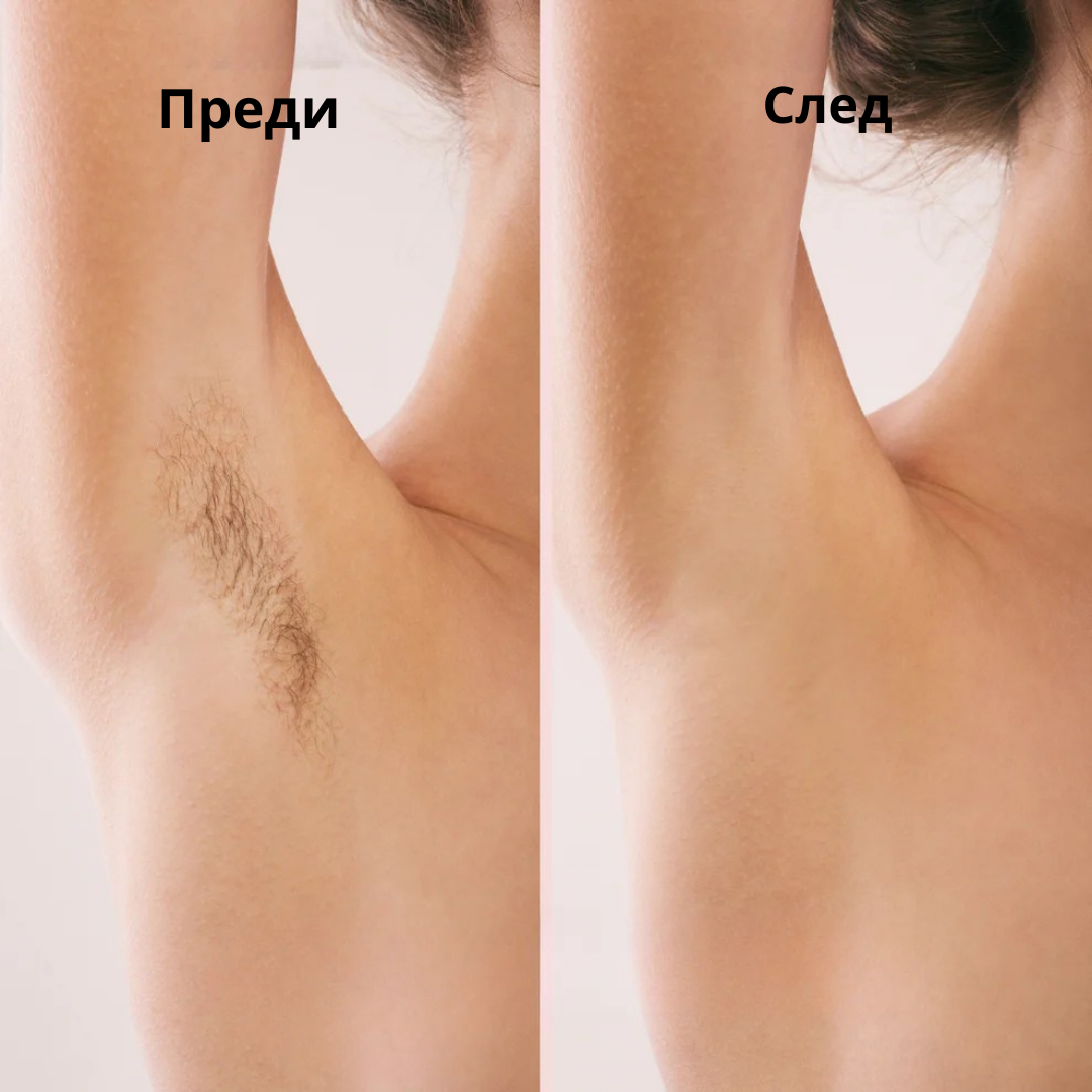 Eunoia® Нежна грижа за чувствителната зона