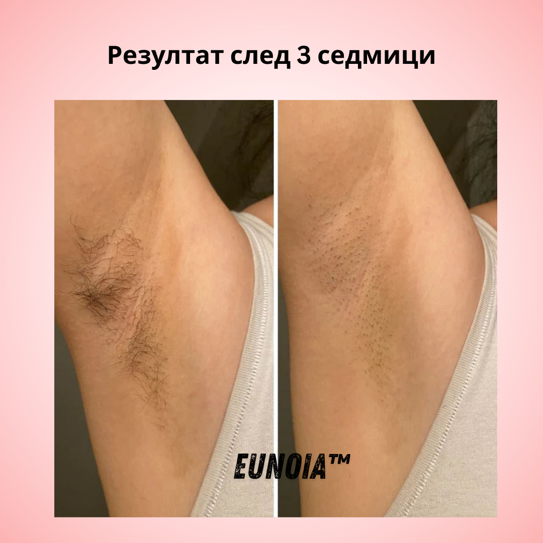 Eunoia® Нежна грижа за чувствителната зона