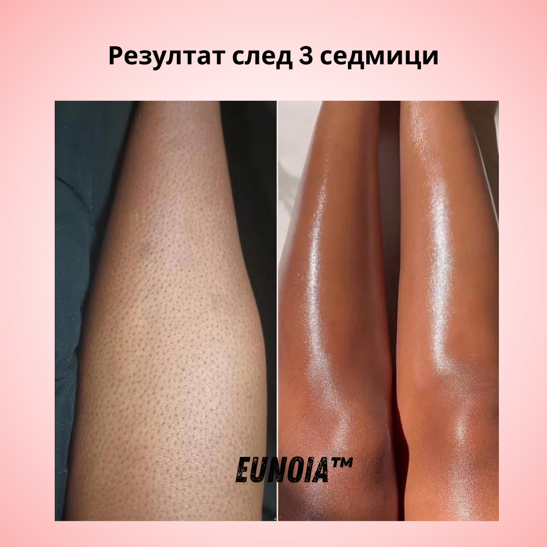 Eunoia® Нежна грижа за чувствителната зона