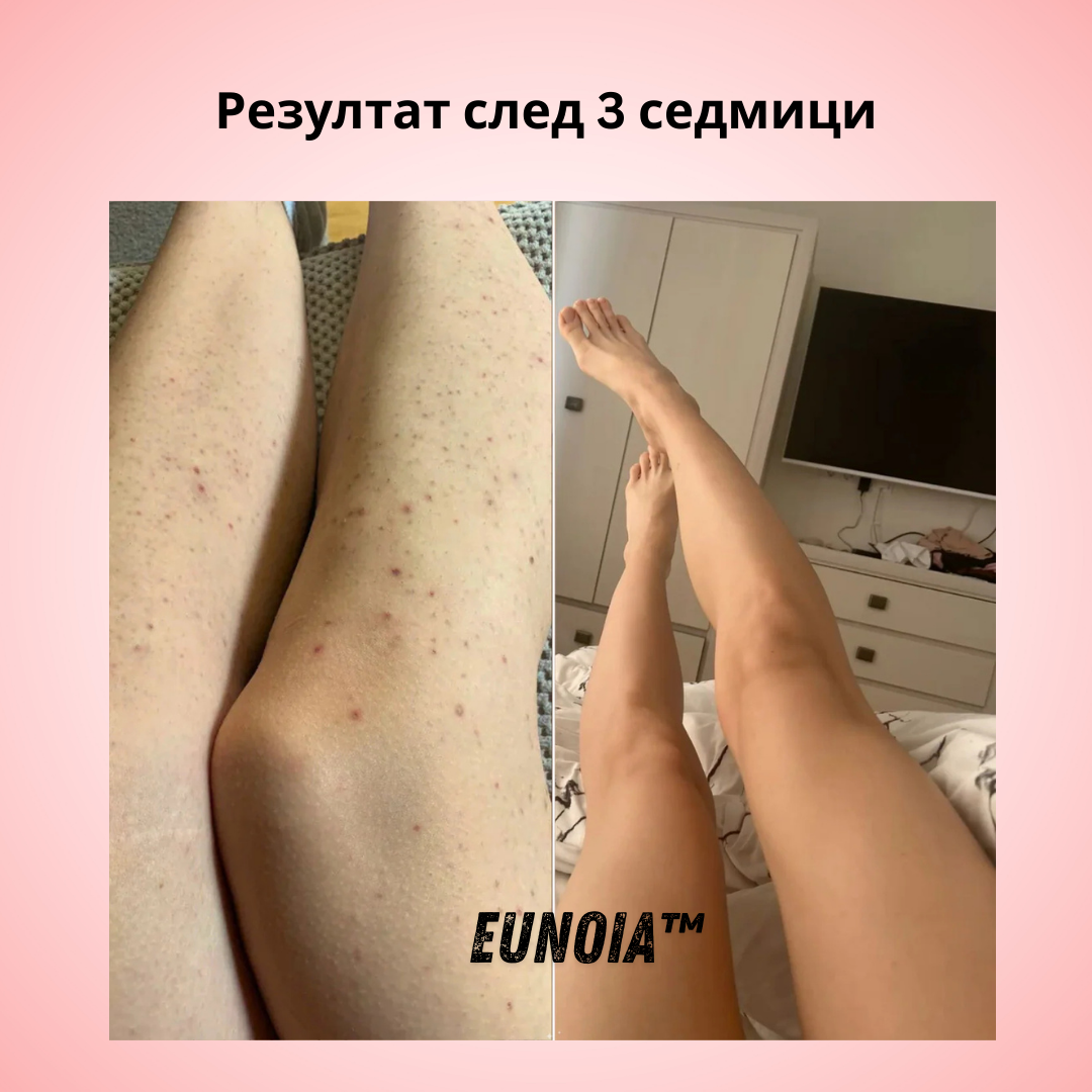 Eunoia® Нежна грижа за чувствителната зона
