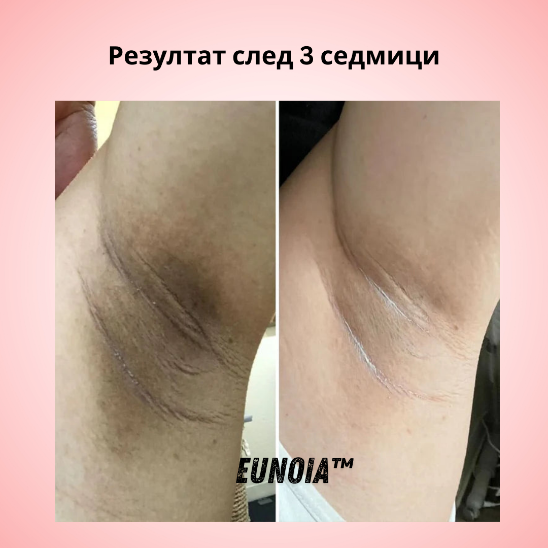 Eunoia® Нежна грижа за чувствителната зона