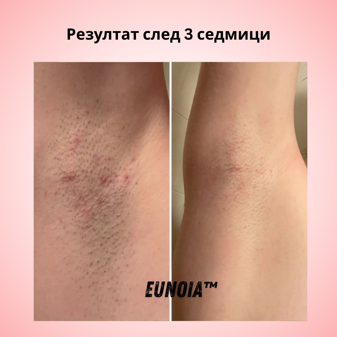 Eunoia® Нежна грижа за чувствителната зона